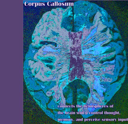 Corpus callosum (digital art by Anna Montgomery)